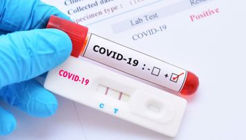 dunyada-son-hefte-qeyde-alinan-qorxulu-koronavirus-statistikasi